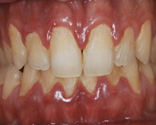 igiene-orale-1