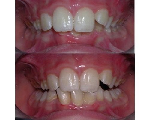 ortodonzia-5