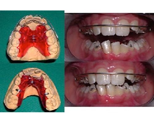 ortodonzia-6