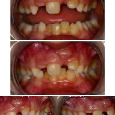 ortodonzia-1
