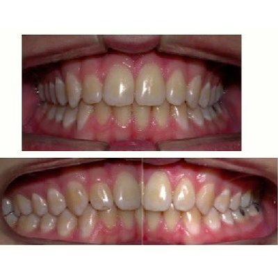 ortodonzia-4