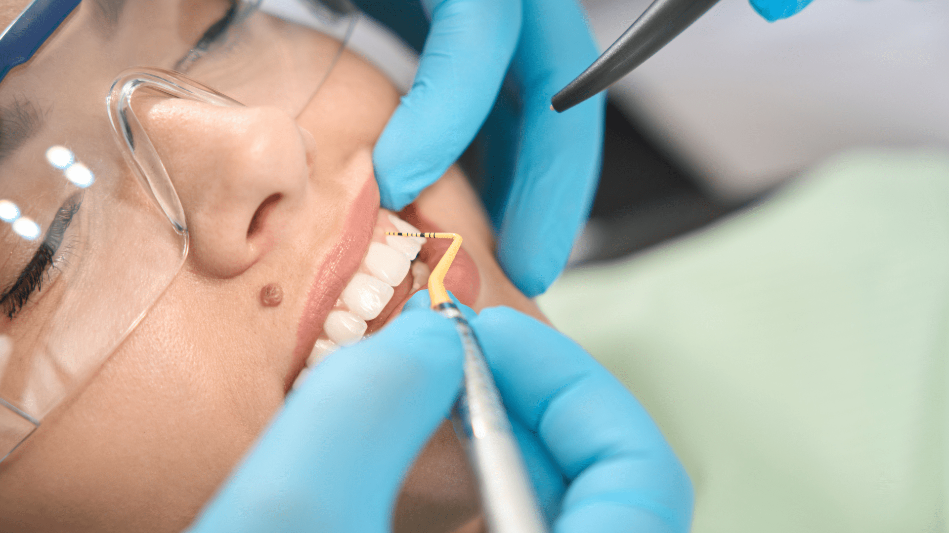 Igiene orale professionale: ogni quanto farla e cosa succede davvero durante la seduta